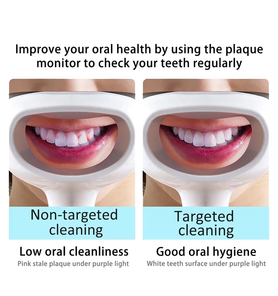 Dental Plaque Monitor Handheld Oral Plaque Finder with Specific Orange and Red Fluorescence Detection Radiation Free and Without Dye for Kids & Adults